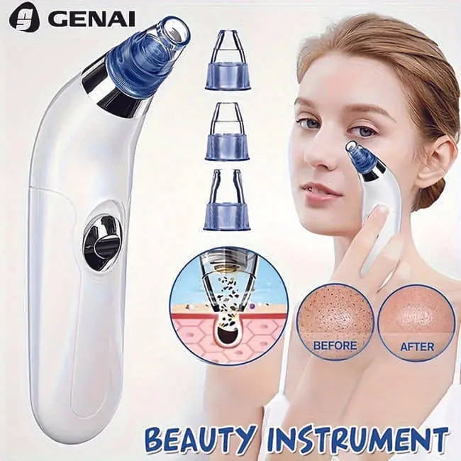3 in 1 Derma Suction – Blackhead Remover & Pore Cleaner