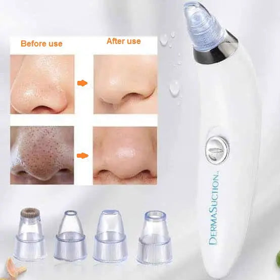 3 in 1 Derma Suction – Blackhead Remover & Pore Cleaner