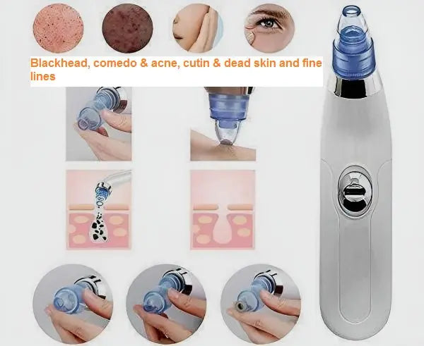 3 in 1 Derma Suction – Blackhead Remover & Pore Cleaner