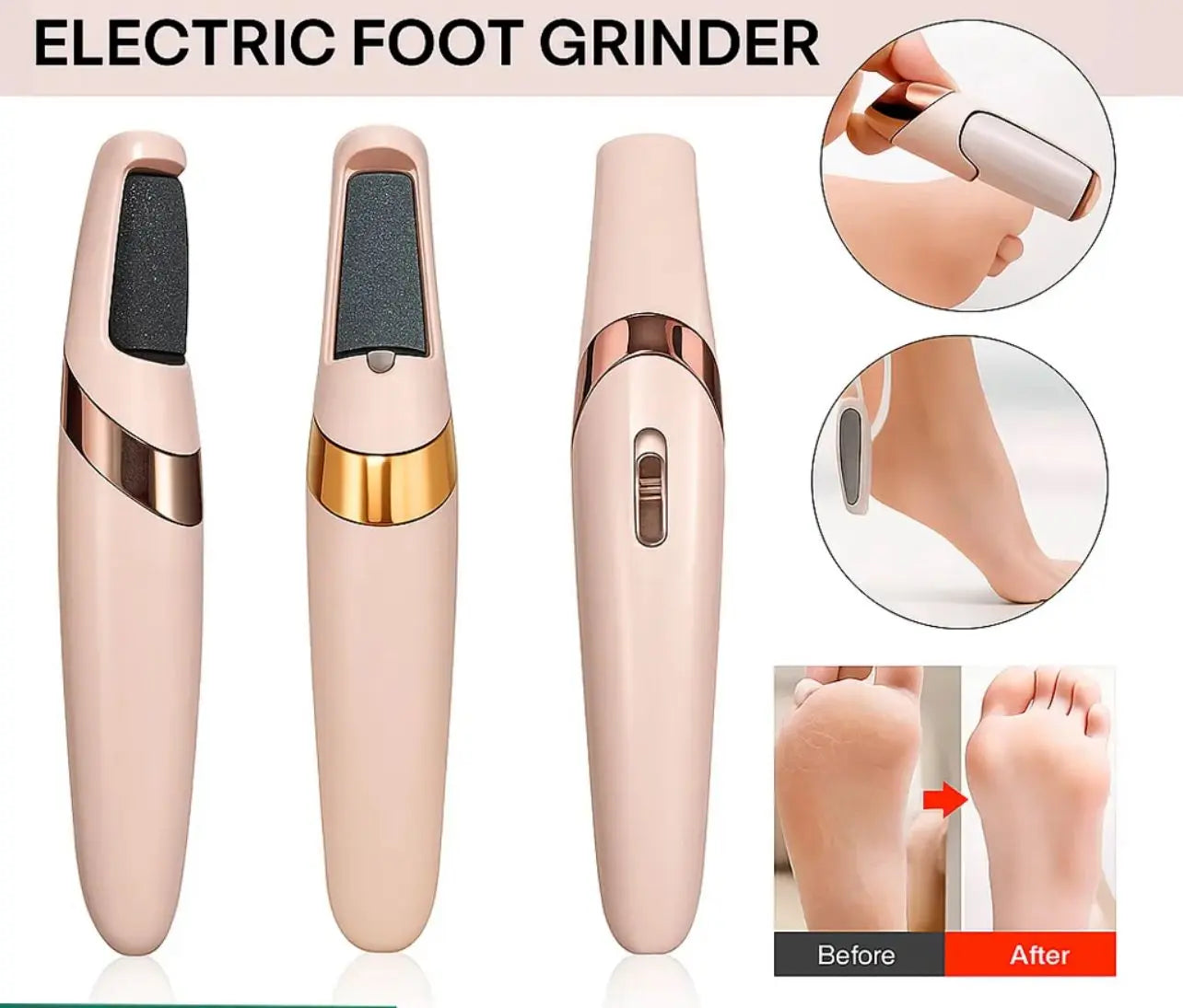 Electric Dead Skin Remover