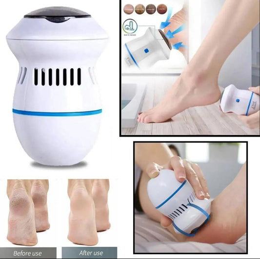 Electric Foot File Vacuum Callus Remover